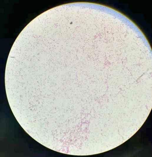 布鲁氏杆菌-布鲁氏杆菌病检测方法